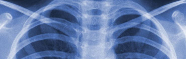 radiologia-convenzionale-jarno-morbiducci-radiodiagnostica